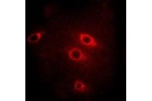 Immunofluorescent analysis of 14-3-3 beta staining in Hela cells. (YWHAB 抗体)