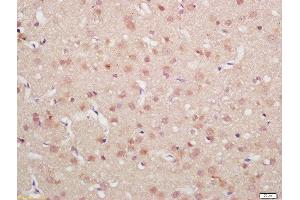 Formalin-fixed and paraffin embedded rat brain labeled with Rabbit Anti-MDM2(Ser186) Polyclonal Antibody, Unconjugated  at 1:200 followed by conjugation to the secondary antibody and DAB staining (MDM2 抗体  (pSer186))
