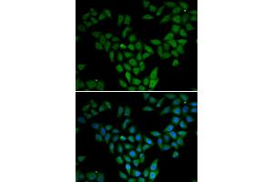 Immunofluorescence analysis of HeLa cells using ASF1A antibody (ABIN5973912). (ASF1A 抗体)