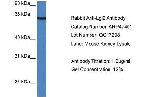 Western Blotting (WB) image for anti-Leucine-Rich Repeat LGI Family, Member 2 (LGI2) (Middle Region) antibody (ABIN2782947) (LGI2 抗体  (Middle Region))