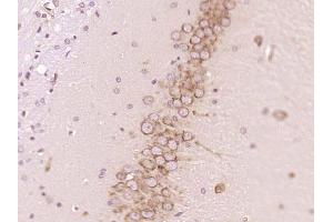 Paraformaldehyde-fixed, paraffin embedded rat brain; Antigen retrieval by boiling in sodium citrate buffer (pH6) for 15min; Block endogenous peroxidase by 3% hydrogen peroxide for 30 minutes; Blocking buffer (normal goat serum) at 37°C for 20min; Antibody incubation with PTPN5/STEP Polyclonal Antibody, Unconjugated (bs-11328R) at 1:200 overnight at 4°C, followed by a conjugated secondary and DAB staining. (PTPN5 抗体  (AA 201-300))