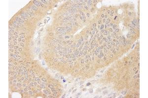 Immunohistochemistry (IHC) image for anti-Coiled-Coil and C2 Domain Containing 1A (CC2D1A) (AA 1-50) antibody (ABIN7455079)