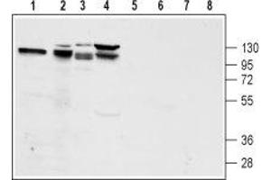 Western blot analysis of rat pancreas lysate (lanes 1 and 5), mouse preadipocyte 3T3-L1 lysate (lanes 2 and 6), rat pancreatic islet cell line RIN-5F lysate (lanes 3 and 7) and human pancreatic carcinoma PANC-1 lysate (lanes 4 and 8): - 1-4. (GLP1R 抗体  (2nd Extracellular Loop))