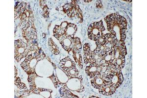Immunohistochemistry (IHC) image for anti-Tight Junction Protein 2 (Zona Occludens 2) (TJP2) (AA 1171-1190), (C-Term) antibody (ABIN3044027)