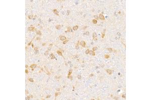Immunohistochemistry of paraffin-embedded rat brain using eIF1A Rabbit mAb (ABIN7267027) at dilution of 1:50 (40x lens).
