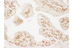 Immunohistochemistry (IHC) image for anti-Promyelocytic Leukemia (PML) (AA 575-625) antibody (ABIN7454723)