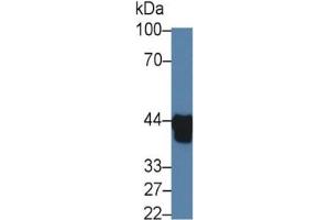 Western Blotting (WB) image for Haptoglobin Related Protein (HPR) ELISA Kit (ABIN6730958)