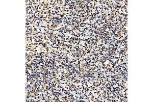 IHC analysis of SMARCA2/BRM using anti-SMARCA2/BRM antibody (ABIN7601969).