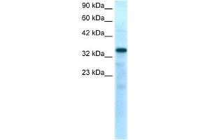 WB Suggested Anti-TBX10 Antibody Titration:  0. (T-Box 10 抗体  (N-Term))