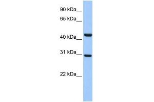 WB Suggested Anti-TULP3 Antibody Titration:  0. (TULP3 抗体  (Middle Region))
