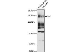 Western blot analysis of extracts of various cell lines, using TrkB antibody (ABIN3022911, ABIN3022912, ABIN3022913 and ABIN6219292) at 1:1000 dilution. (TRKB 抗体  (AA 32-282))