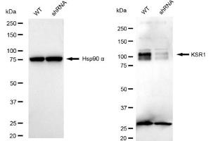 Western blotting analysis using KSR1 antibody (ABIN7799197).