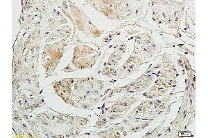 Immunohistochemistry (IHC) image for anti-Purinergic Receptor P2x, Ligand-Gated Ion Channel, 3 (P2RX3) (AA 241-340) antibody (ABIN705866)