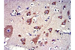 Immunohistochemical analysis of paraffin-embedded brain tissues using LPlunc1 mouse mAb with DAB staining.