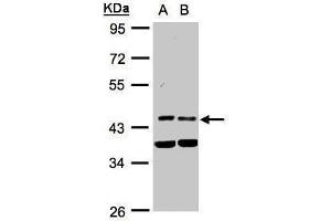 WB Image Sample(30 ug whole cell lysate) A:HeLa S3, B:MOLT4 , 10% SDS PAGE antibody diluted at 1:1000 (PDK1 抗体)