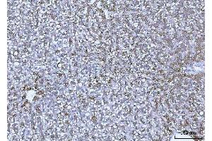 IHC analysis of GLUD1/2 using anti-GLUD1/2 antibody (ABIN7602000). (GLUD1 / GLUD2 (AA 54-553) 抗体)