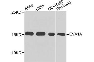Western blot analysis of extracts of various cell lines, using EVA1A antibody (ABIN5975697) at 1/1000 dilution. (TMEM166 抗体)