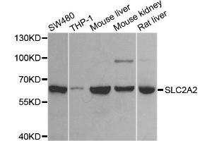 Western blot analysis of extracts of various cell lines, using SLC2A2 antibody. (SLC2A2 抗体)