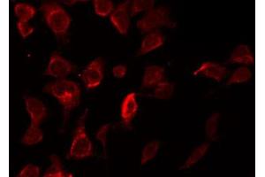 ABIN6269302 staining HepG2 by IF/ICC. (XIAP 抗体  (N-Term))