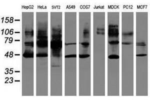 Image no. 2 for anti-serpin Peptidase Inhibitor, Clade B (Ovalbumin), Member 1 (SERPINB1) (AA 77-306) antibody (ABIN1491672) (SERPINB1 抗体  (AA 77-306))