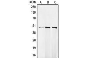 Western blot analysis of MOK expression in Raji (A), MDAMB231 (B), A549 (C) whole cell lysates.
