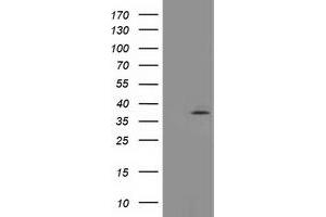 Western Blotting (WB) image for anti-Translocase of Outer Mitochondrial Membrane 34 (TOMM34) antibody (ABIN1501469) (TOMM34 抗体)