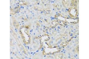 Immunohistochemistry of paraffin-embedded Rat kidney using AHCYL1 Polyclonal Antibody at dilution of 1:100 (40x lens). (AHCYL1 抗体)