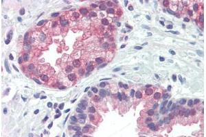 Human Prostate (formalin-fixed, paraffin-embedded) stained with BNIP3 antibody ABIN461995 at 10 ug/ml followed by biotinylated anti-mouse IgG secondary antibody ABIN481714, alkaline phosphatase-streptavidin and chromogen. (BNIP3 抗体  (AA 112-124))