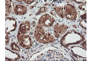 Immunohistochemical staining of paraffin-embedded Human Kidney tissue using anti-NLN mouse monoclonal antibody. (NLN 抗体)