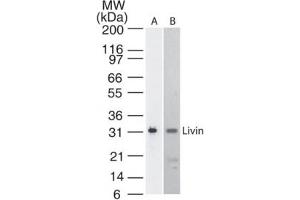 Livin BIRC7 KIAP Western Blot. (BIRC7 抗体)