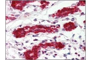 Immunohistochemistry (IHC) image for anti-Programmed Cell Death 4 (PDCD4) (AA 1-469), (N-Term) antibody (ABIN317548) (PDCD4 抗体  (N-Term))