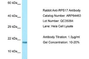 Western Blotting (WB) image for anti-Ribosomal Protein S17 (RPS17) (Middle Region) antibody (ABIN2789845) (RPS17 抗体  (Middle Region))