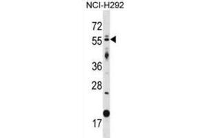Western Blotting (WB) image for anti-GLIS Family Zinc Finger 2 (GLIS2) antibody (ABIN2998792) (GLIS2 抗体)