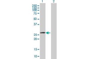 Western Blot analysis of OSTF1 expression in transfected 293T cell line by OSTF1 MaxPab polyclonal antibody. (OSTF1 抗体  (AA 1-217))