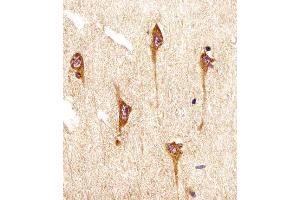 Immunohistochemistry (Paraffin-embedded Sections) (IHC (p)) image for anti-Neurotrophic Tyrosine Kinase, Receptor, Type 2 (NTRK2) antibody (ABIN4912550)