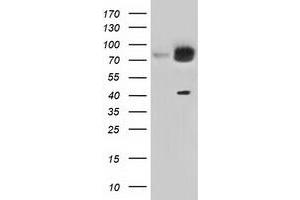 Western Blotting (WB) image for anti-Kelch Repeat and BTB (POZ) Domain Containing 7 (KBTBD7) antibody (ABIN1498995) (KBTBD7 抗体)