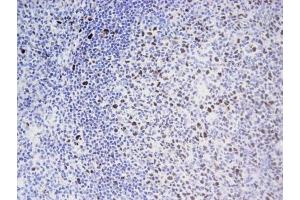 EED mAb tested by Immunohistochemistry . (EED 抗体)