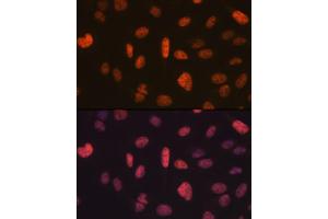 anti-Fat Mass and Obesity-Associated (FTO) antibody