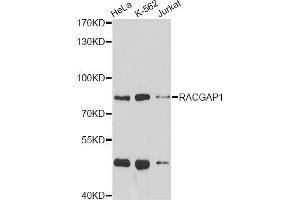 Western blot analysis of extracts of various cell lines, using RACGAP1 antibody (ABIN5973044) at 1/1000 dilution. (RACGAP1 抗体)