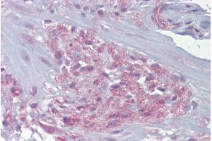 Immunohistochemistry with Small intestine, myetneric plexus tissue at an antibody concentration of 5-10µg/ml using anti-FREQ antibody (ARP34711_P050) (NCS1 抗体  (Middle Region))