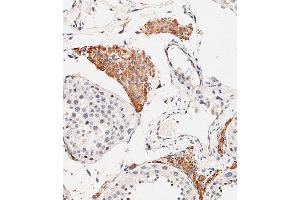Immunohistochemical analysis of paraffin-embedded human testis tissue using C performed on the Leica® BOND RXm. (OTUD3 抗体  (AA 192-220))