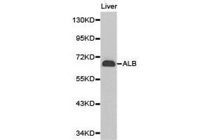 Western Blotting (WB) image for anti-Albumin (ALB) antibody (ABIN2650895) (Albumin 抗体)