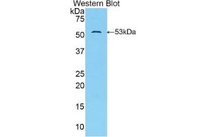 Western blot analysis of the recombinant protein. (SLC2A14 抗体  (AA 51-105))
