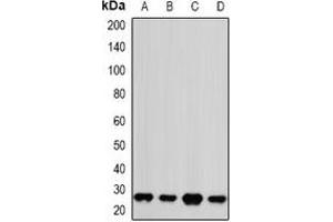 Western blot analysis of PSMA2 expression in Jurkat (A), Hela (B), NIH3T3 (C), mouse brain (D) whole cell lysates.