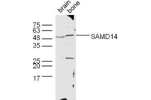 Lane 1: Mouse brain lysates, Lane 2: Mouse bone lysates probed with SAMD14 Polyclonal Antibody, unconjugated  at 1:300 overnight at 4°C followed by a conjugated secondary antibody at 1:10000 for 60 minutes at 37°C. (SAMD14 抗体  (AA 231-330))