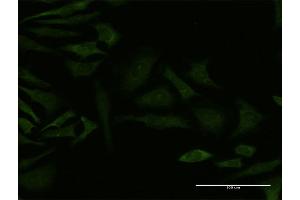 Immunofluorescence of monoclonal antibody to GRK4 on HeLa cell. (GRK4 抗体  (AA 36-145))