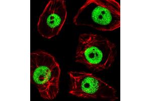 Fluorescent image of MDA-M cells stained with TPD52L3 Antibody (N-term) A. (TPD52L3 抗体  (N-Term))