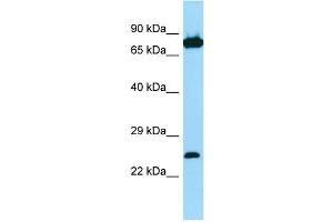 Host: Rabbit Target Name: SNX27 Sample Type: Jurkat Whole Cell lysates Antibody Dilution: 1. (SNX27 抗体  (C-Term))