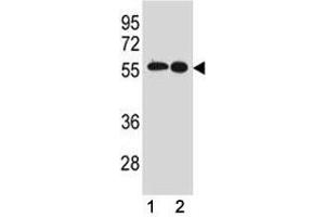 Src antibody western blot analysis in (1) MCF-7 and (2) A431 lysate (Src 抗体  (AA 24-52))