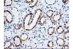 Immunohistochemistry (IHC) image for anti-Insulin-Like Growth Factor 2 mRNA Binding Protein 2 (IGF2BP2) antibody (ABIN1498821) (IGF2BP2 抗体)